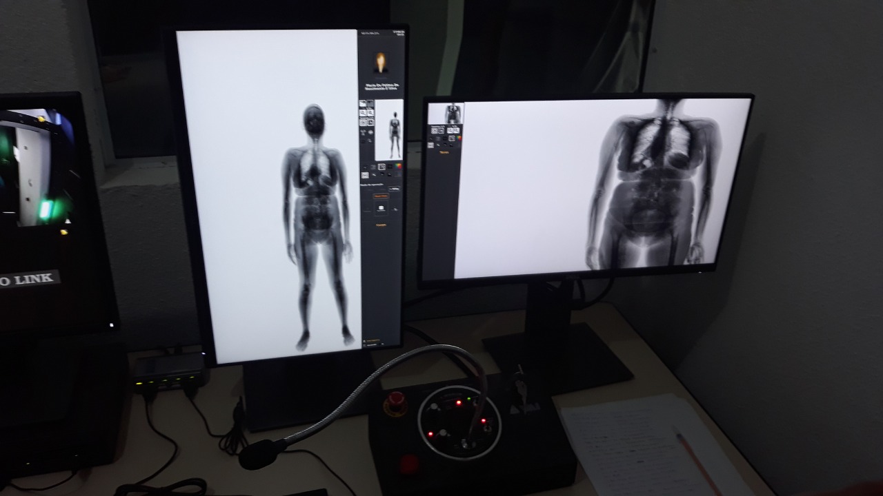 Presídio de Alcaçuz passa a operar o “body scan” em dia de visitas - Agora RN