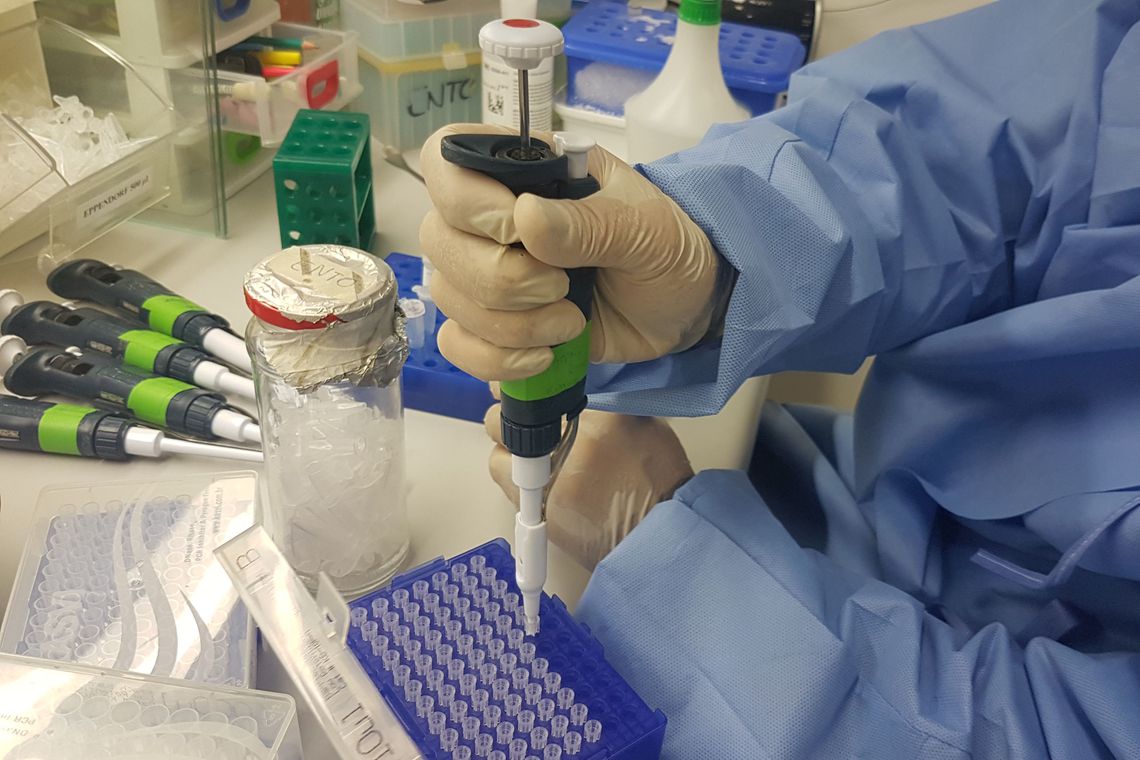 Exame para identificar vírus Zika é comercializado no país - Agora RN