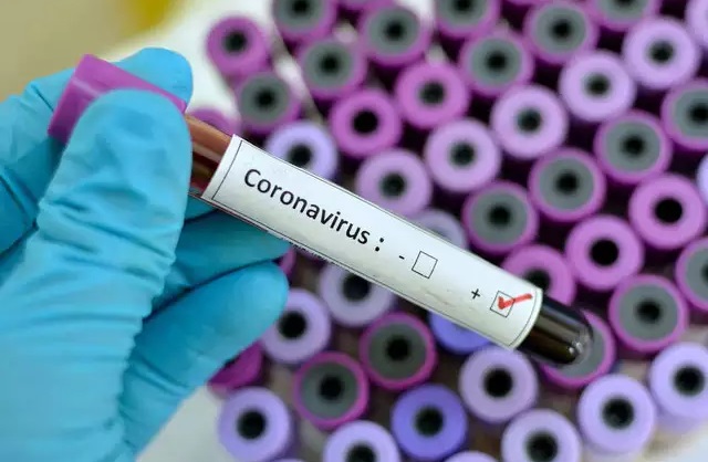 Secretarias de Saúde confirmam 301 casos de coronavírus no Brasil; RN segue com 1 caso - Agora RN