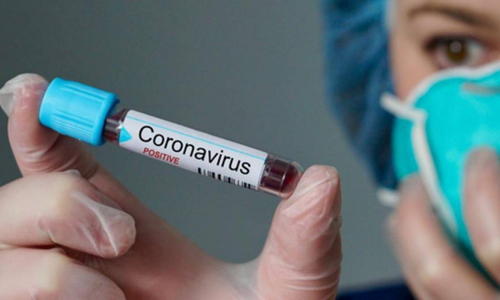 Ministério da Saúde promete 22,9 milhões de testes do novo coronavírus - Agora RN