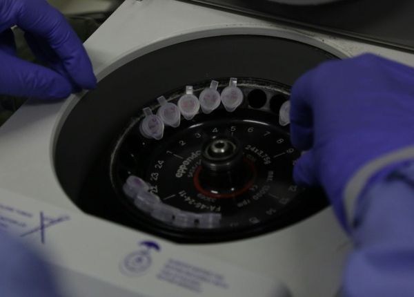 Estados e municípios relatam subnotificação gigantesca de casos - Agora RN