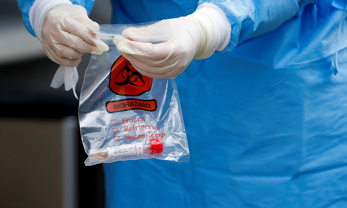 Covid-19: Estudo indica que maioria de infectados cria anticorpos - Agora RN