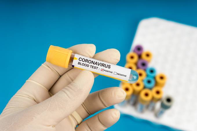 RN tem 122 mortes por Covid-19 e 2.786 casos confirmados da infecção - Agora RN
