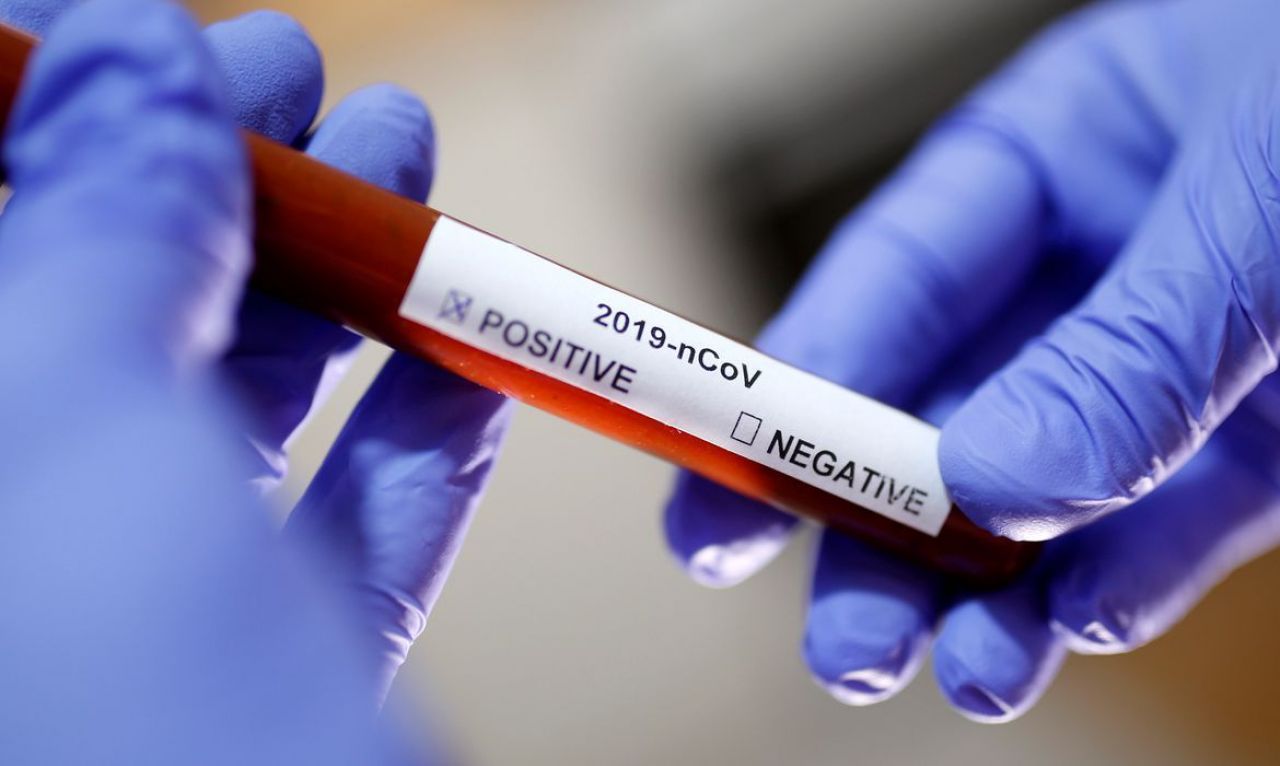 RN contabiliza 170 mortes por Covid-19 e 3.796 casos confirmados da doença - Agora RN