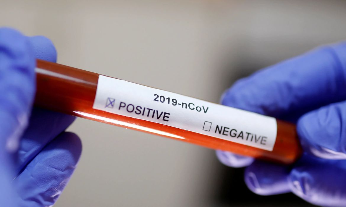 475 profissionais de saúde testaram positivo para o coronavírus no RN - Agora RN