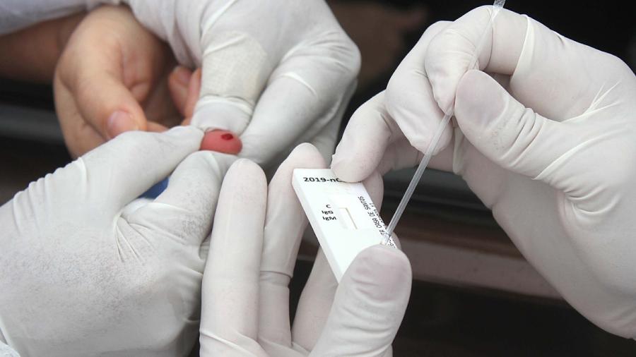 RN contabiliza 626 mortes por Covid-19; outras 129 estão em investigação - Agora RN