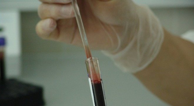 Covid-19 atrasou o tratamento de 43% dos pacientes com câncer - Agora RN