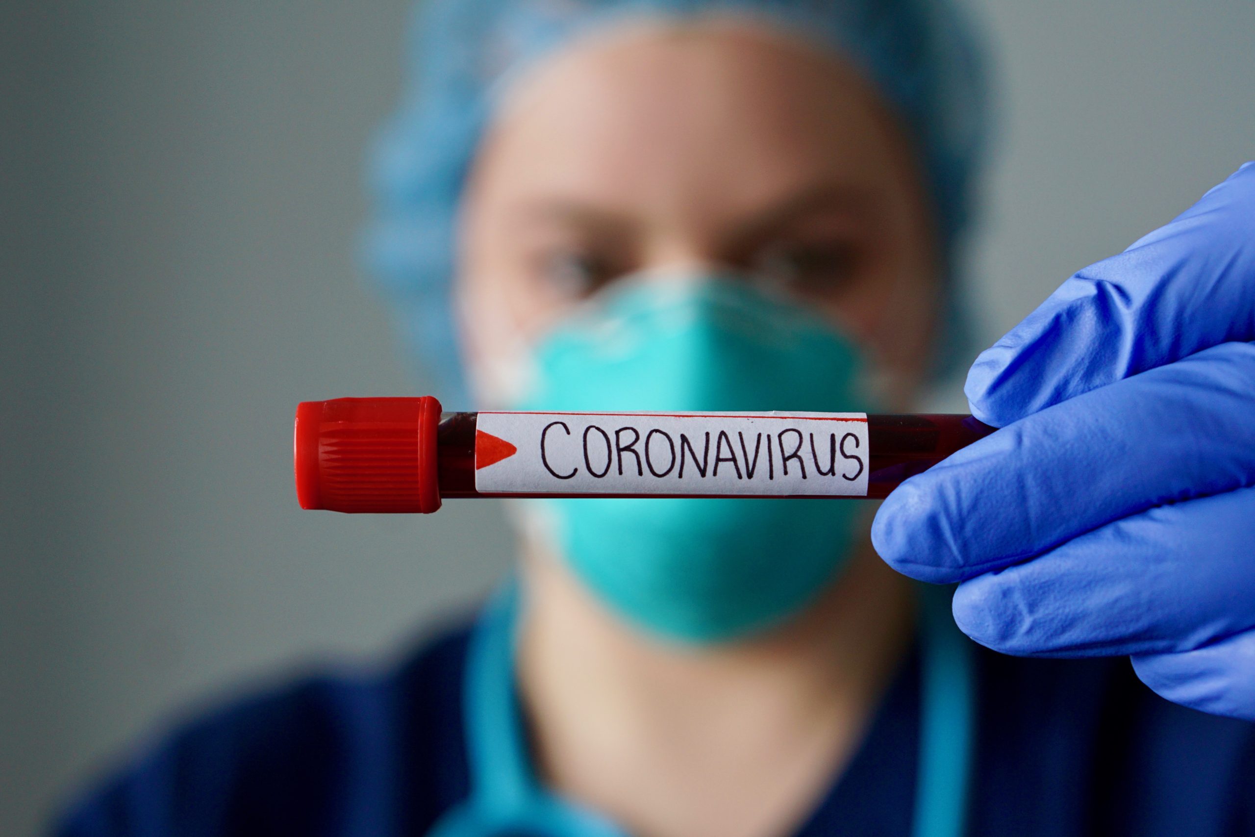 RN registra 10 novos óbitos por Covid-19 nas últimas 24h; total é de 1.526 mortes - Agora RN