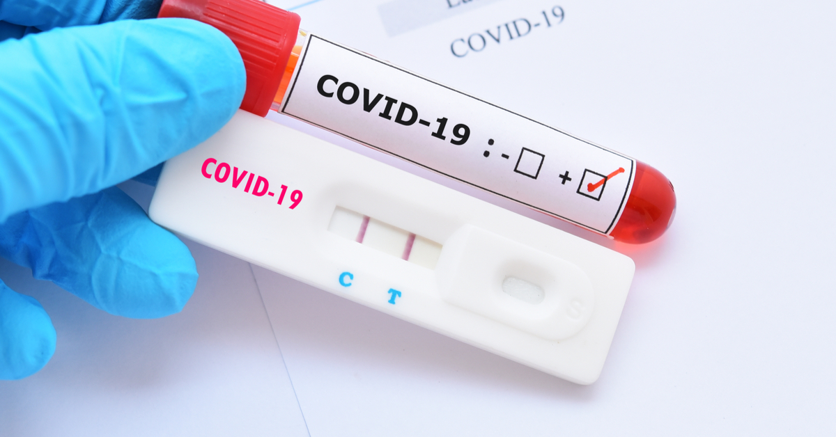 Covid-19: RN soma 1.344 óbitos e 37.046 casos confirmados, diz Sesap - Agora RN