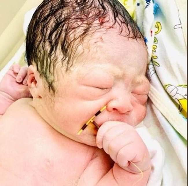 Bebê chama atenção ao nascer segurando DIU que não evitou gravidez - Agora RN