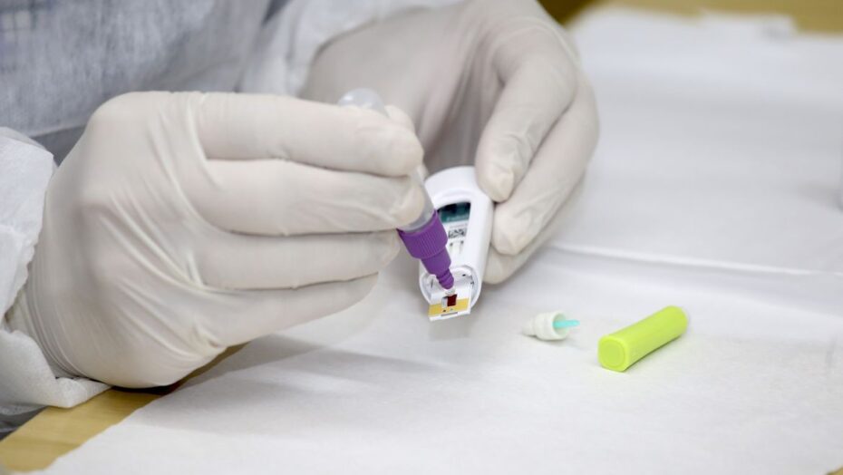 Brasil registra 3,8 milhões de casos do novo coronavírus - Agora RN