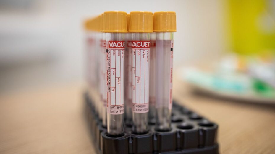 Covid-19: pfizer e biontech pedem uso emergencial de vacina na europa