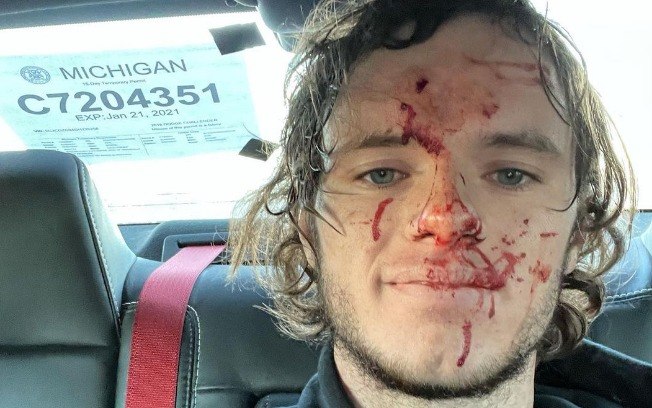 Youtuber atira, bala ricocheteia e o acerta na cabeça: "não sei como estou vivo" | notícias do rio grande do norte Youtuber atira, bala ricocheteia e o acerta na cabeça: “não sei como estou vivo”