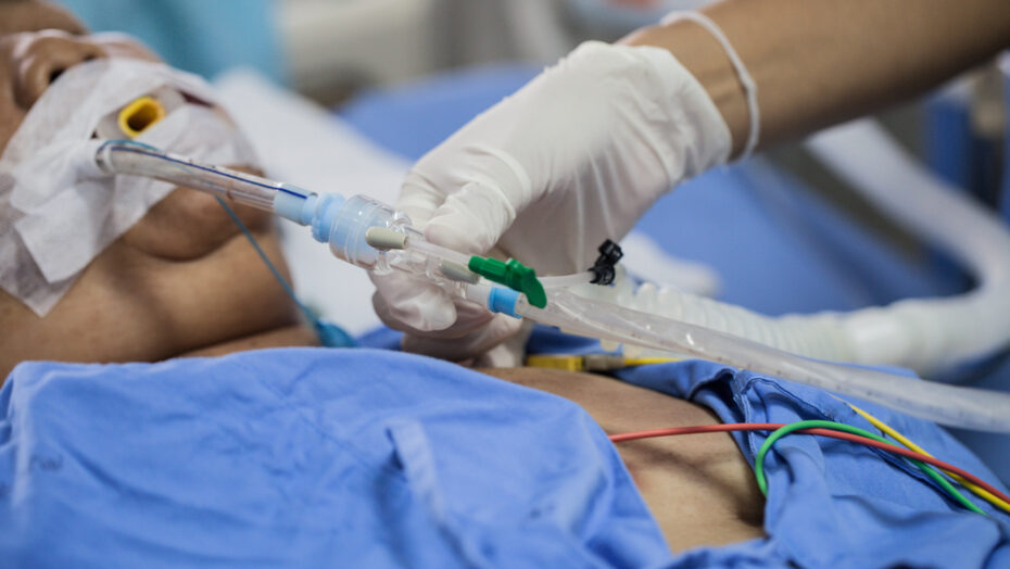 83,7% dos intubados por covid no nordeste morreram em 2020