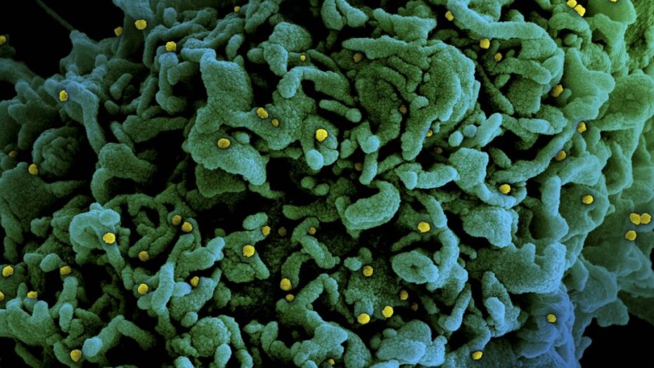 Cientistas em alerta: estudo mostra que variante p1 do coronavírus escapa de e tem potencial para causar reinfecção