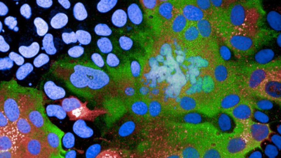 pigmento especial de laboratorio revela areas onde variante delta do coronavirus invadiu ce
