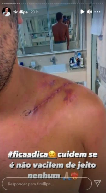 Tirullipa sofre acidente, passa por cirurgia e mostra cicatriz enorme: “11 parafusos e uma placa”