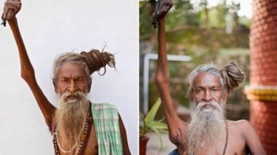 Conheça o homem indiano que mantém braço direito levantado há 45 anos | notícias do rio grande do norte Conheça o homem indiano que mantém braço direito levantado há 45 anos