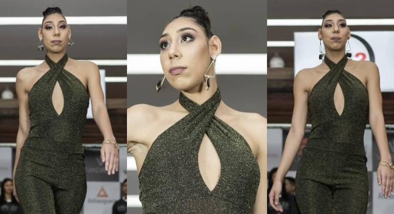 Conheça a brasileira que se tornou a primeira modelo com microcefalia do mundo