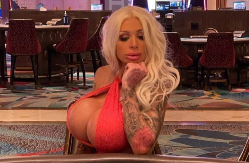 Atriz poRio Grande do Norteô é inteRio Grande do Norteada após prótese de silicone explodir - Agora RN