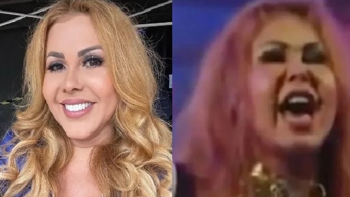 Cantora joelma é diagnosticada com esofagite, gastrite e edema | notícias do rio grande do norte joelma 2