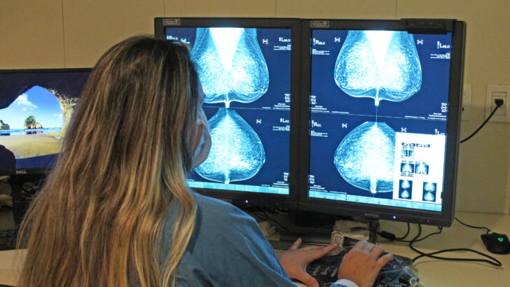 Profissional de saúde observa exames de mamografia em monitores