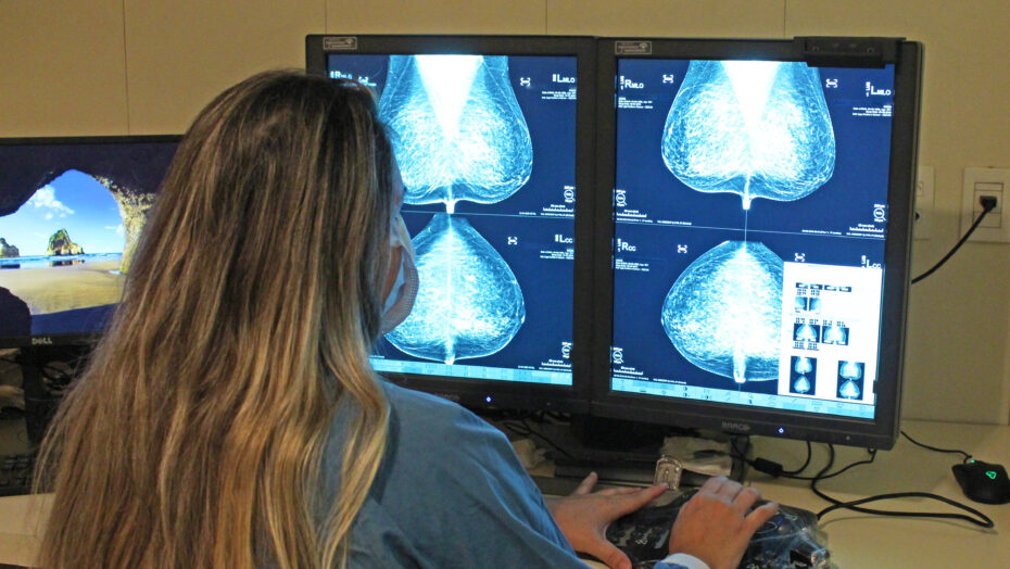 Outubro Rosa simboliza a luta contra o câncer de mama e, para combater essa doença, há duas ferramentas importantes: a prevenção e o diagnóstico precoce. Foto: Liga Contra o Câncer