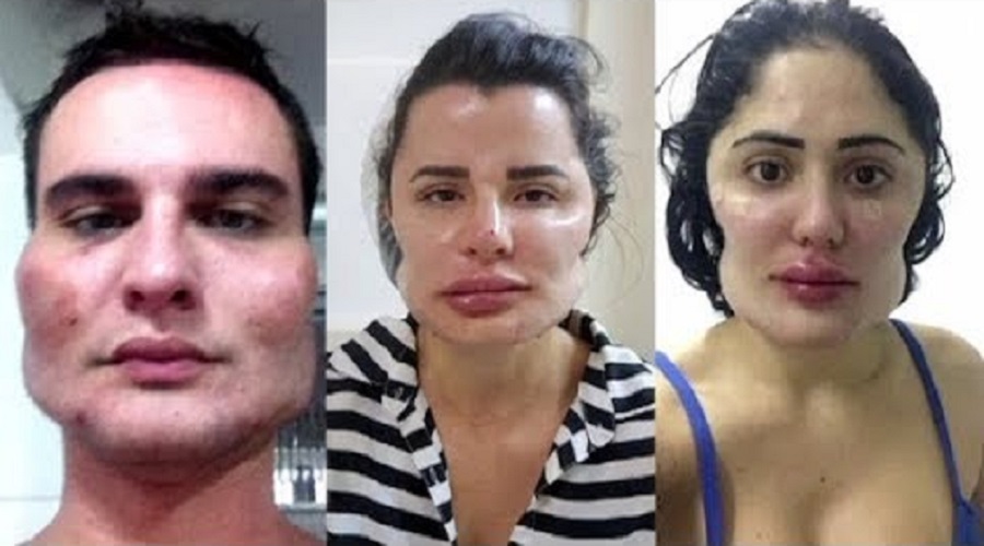 Pacientes do médico estético que foi condenado em Goiás / Foto: reprodução