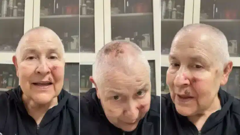 Monja Coen Cancer