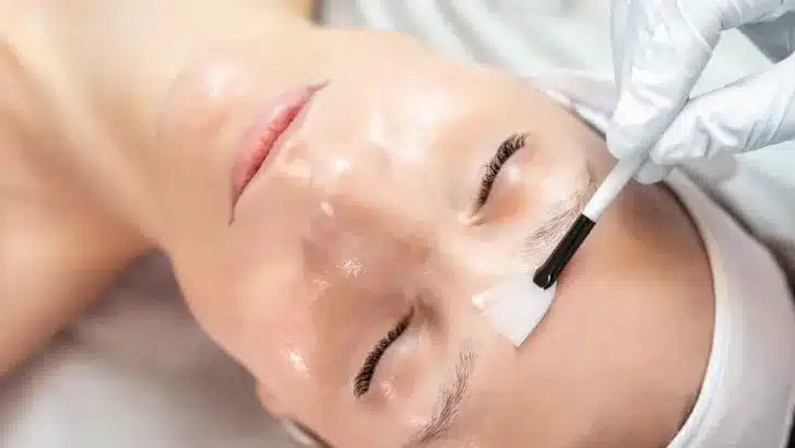 peeling de fenol