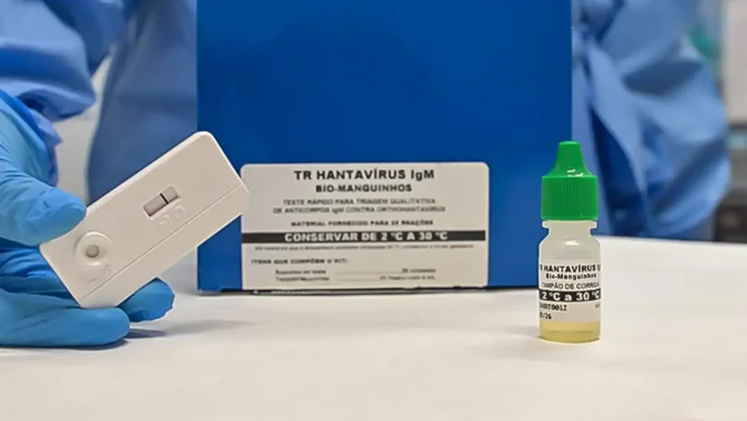 Novo teste faz diagnóstico de hantavirose em 20 minutos | notícias do rio grande do norte dsc 2618 copy