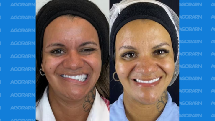 Mulher que foi agredida com 61 socos passa por novo procedimento facial e mostra resultado - Foto: Reprodução/Instagram