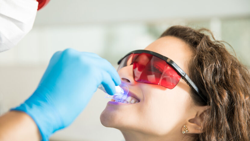 closeup young woman having her teeth whitened with ultraviolet light dental clinic