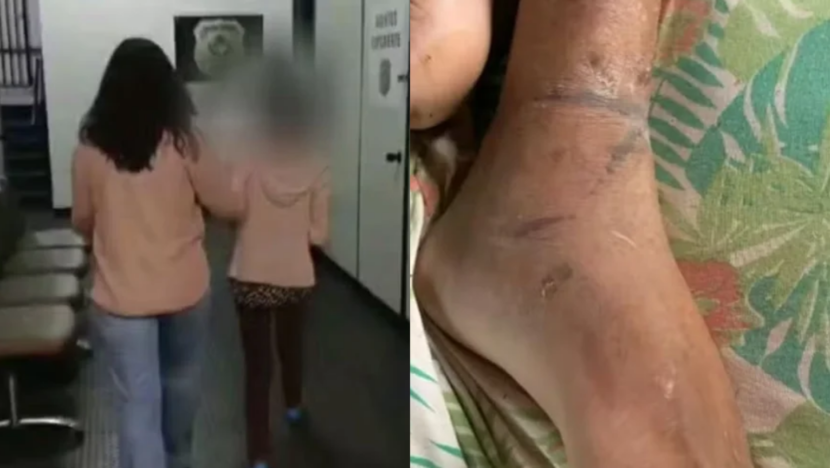 Homem mantido acorrentado pela mãe em goiás sofreu três avcs e passou dias sem comida, diz polícia | notícias do rio grande do norte filho acorrentado