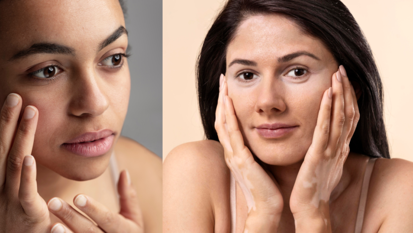 Dermatologista alerta para riscos de receitas caseiras e dicas da internet | notícias do rio grande do norte capa portal 2026 07 17T144757.689