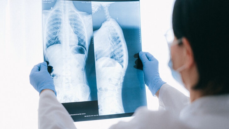 Profissional de saúde de jaleco, luvas e máscara observa radiografias de tórax contra a luz