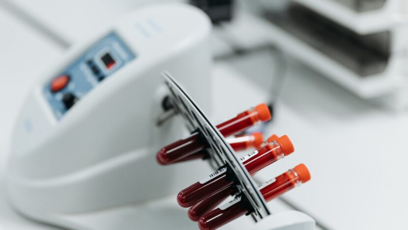 Tubos de coleta com sangue e tampas vermelhas encaixados em equipamento de laboratório