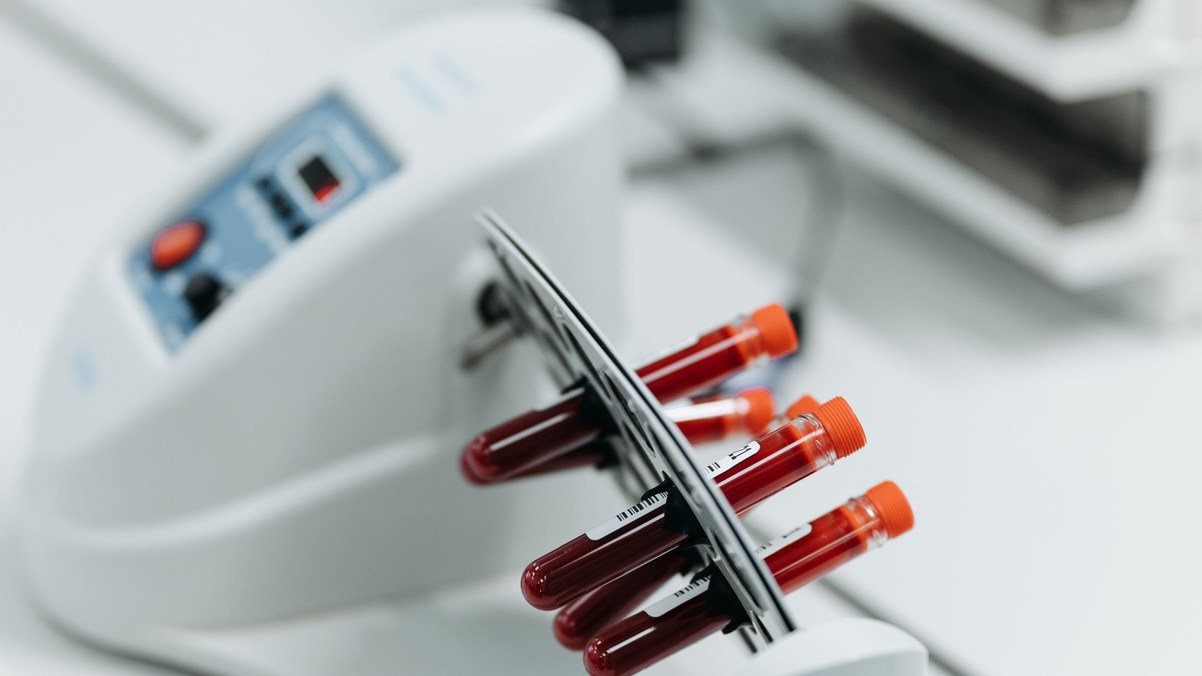 Proteínas do sangue revelam a idade biológica, diz estudo