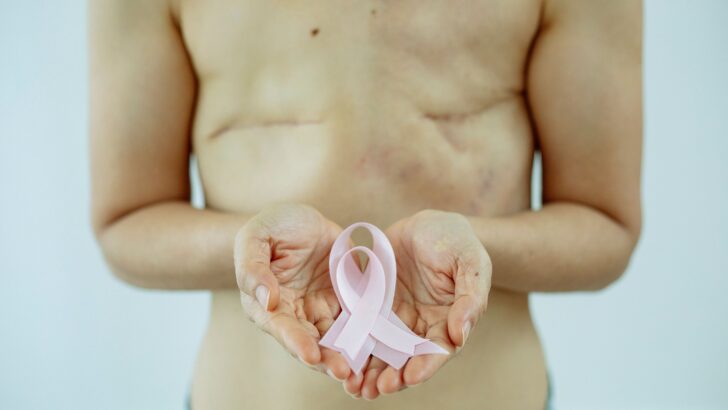 Pessoa com cicatrizes no tórax segura nas duas mãos um laço rosa, símbolo da luta contra o câncer de mama
