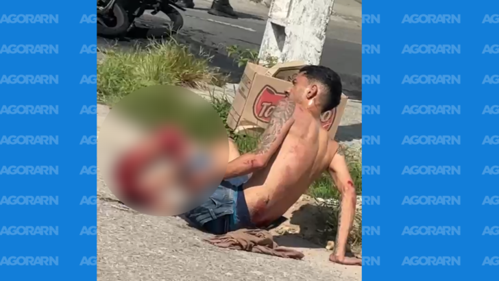 Homem caído no chão após sofrer fratura em acidente na Zona Norte de Natal