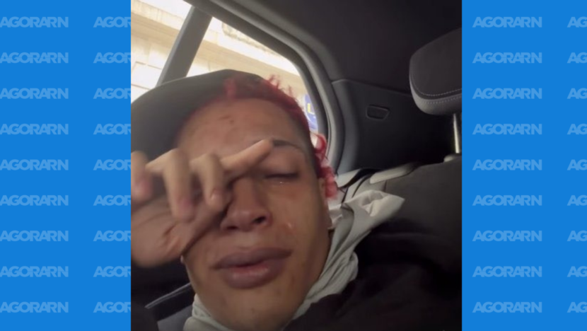 Pessoa de cabelos avermelhados, com os olhos fechados e a mão sobre o rosto, sentada no banco traseiro de um carro