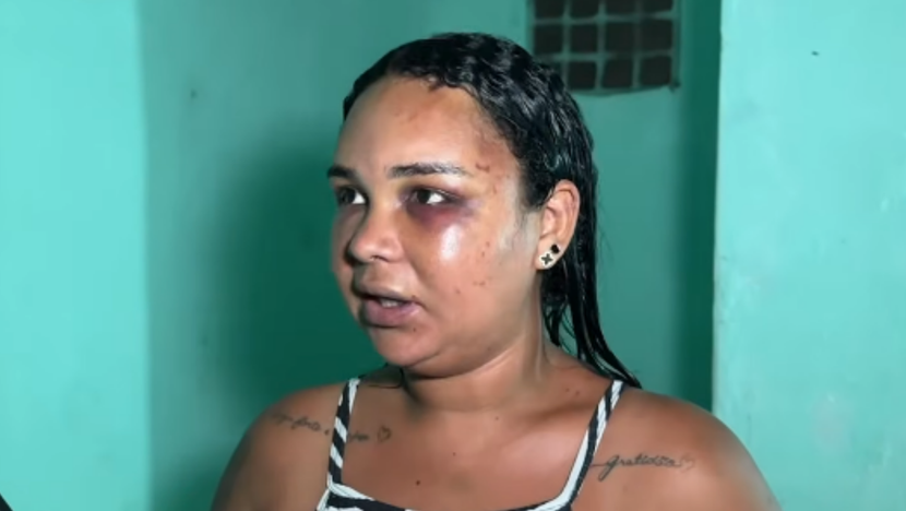 Mulher denuncia ex-companheiro por espancamento e ameaças de morte após audiência de custódia