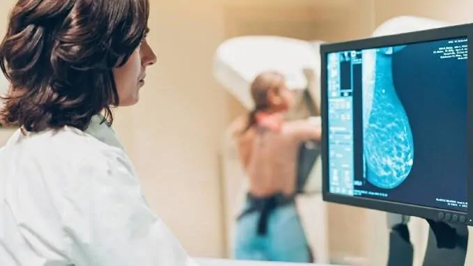 ANS amplia mamografia em planos para mulheres a partir de 40 anos para rastreio do câncer de mama Foto: Reprodução